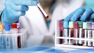 پیشرفت فناوری در آزمایشگاه خون شناسی - آژانس خبری مهر | اخبار ایرانی و جهانی