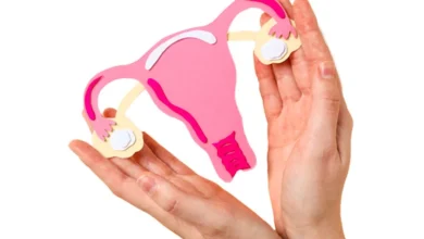 راه های درمان تنبلی تخمدان + خانه درمانی - سلامت Radina