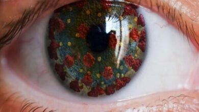 علائم چشم را جدی بگیرید