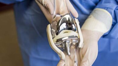 حقایق عجیب در مورد تعویض مفصل زانو!