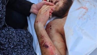 درخواست نظام پرستاری برای برخورد با جنایت رژیم صهیونیستی