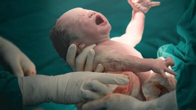 لزوم ترویج زایمان طبیعی بدون درد در کشور