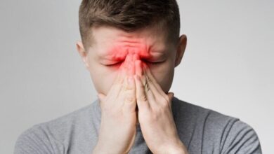 چند نکته در مورد سردرد سینوسی