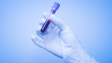 کاهش کلسترول بد خون خطر ابتلا به زوال عقل را کم می‌کند