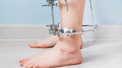 افزایش جراحی در ارتفاع ؛ معجزه مدرن یا شکنجه؟