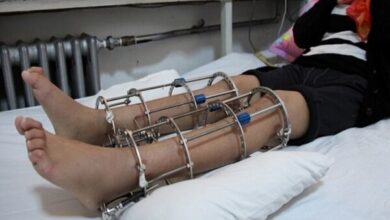 هر آنچه را که باید در مورد جراحی قد بدانید