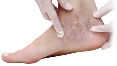 این علائم را در پا جدی بگیرید