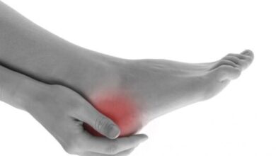 چگونه با گلو پاشنه درمان کنیم؟