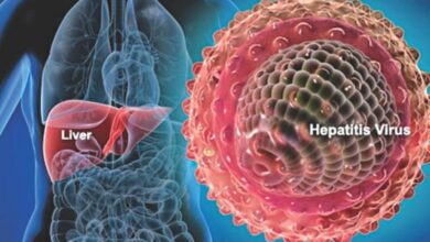 اعلام هپاتیت A در لس آنجلس ایالات متحده - آژانس خبری مهر | اخبار ایرانی و جهانی