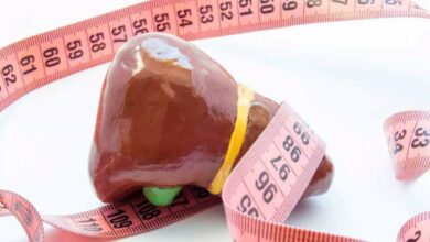 برای کبد چرب چه بخورید؟ - دکتر