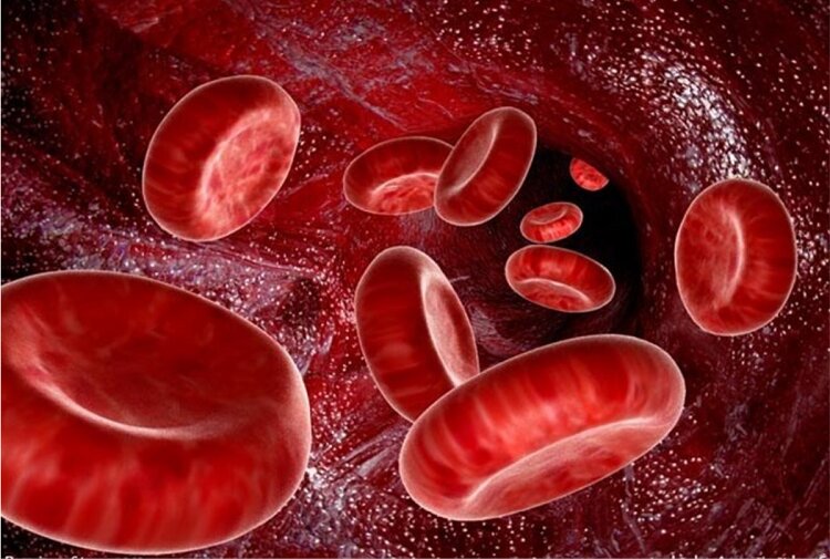 زندگی انسان تحت تأثیر کم خونی و کمبود آهن
