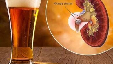 آیا برای بیماران کلیه خوب است یا بد؟