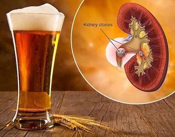 آیا برای بیماران کلیه خوب است یا بد؟