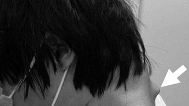 علائم سردرد چیست؟