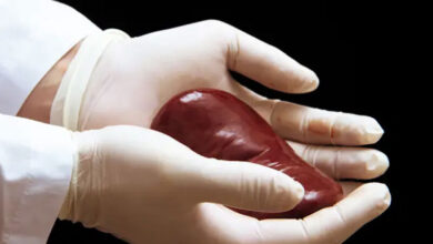 فرهنگ اهدای عضو هنوز ضعیف است/ سه تا چهار هزار بیمار که سالانه به پیوند عضو نیاز دارند