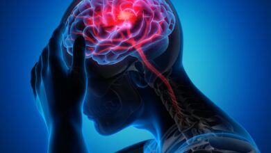 اگر خستگی دائمی دارید ، ممکن است سکته مغزی خفیف داشته باشید!