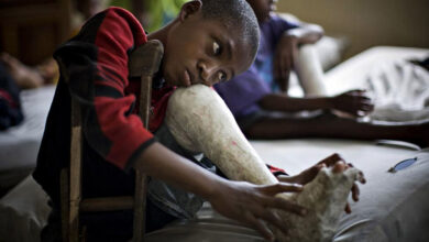 سازمان بهداشت جهانی شیوع فلج اطفال در ماداگاسکار - آژانس خبری مهر | اخبار ایرانی و جهانی