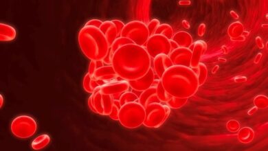 ارائه خدمات به 4 بیمار در مرکز تالاسمی بزرگسالان زفر در تهران