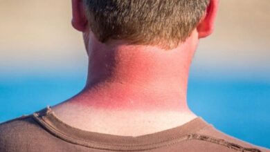 راهکارهای مراقبت از پوست و چشم برای مقابله با نور خورشید