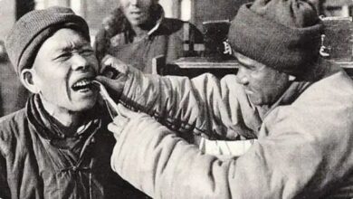 هنری که لبخند را بازسازی کرد/