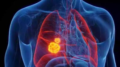 بهترین راهها برای پاکسازی ریه