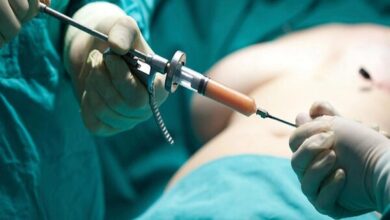 بوتاکس برای کاهش وزن؟ جراح عمومی پاسخ داد - آژانس خبری مهر | اخبار ایرانی و جهانی