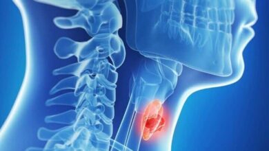 بهترین غذا برای صرفه جویی در تیروئید