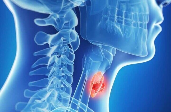 بهترین غذا برای صرفه جویی در تیروئید