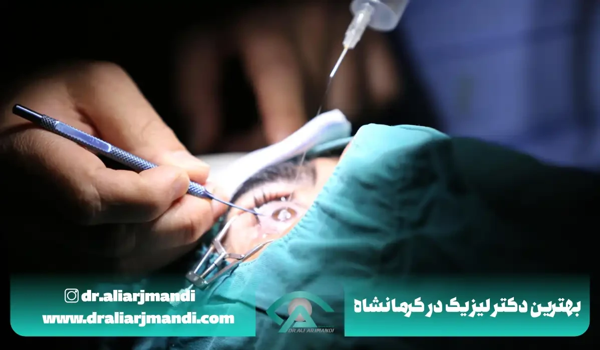 بهترین دکتر لیزیک در کرمانشاه