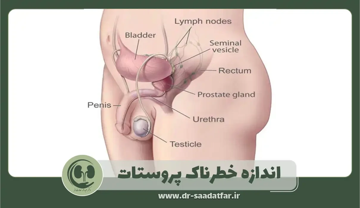 اندازه خطرناک پروستات