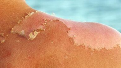 مشاوره مهم پوست به زنان