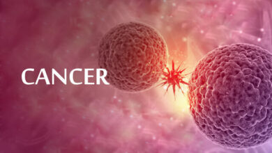 این سرطان بیشتر زنان بالای 5 سال را تحت تأثیر قرار می دهد/ توصیه های کلیدی برای پیشگیری