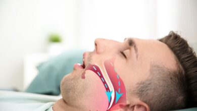 آپنه خواب ؛ یک تهدید ساکت برای قطع تنفس