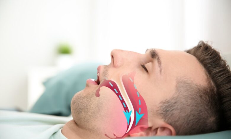 آپنه خواب ؛ یک تهدید ساکت برای قطع تنفس