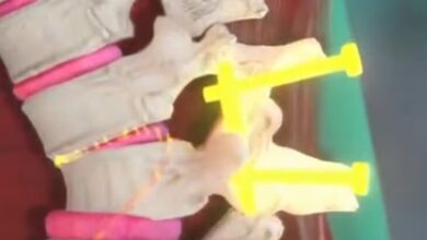 عطسه شدید این زن به مدت دو سال/ عکس