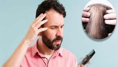 دلیل ریزش مو سکه چیست؟ - آژانس خبری مهر ایرانی و اخبار جهانی