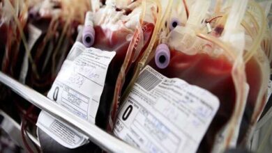 استقرار آزمایشی دستگاه پرتودهی پیشرفته در سازمان انتقال خون ایران