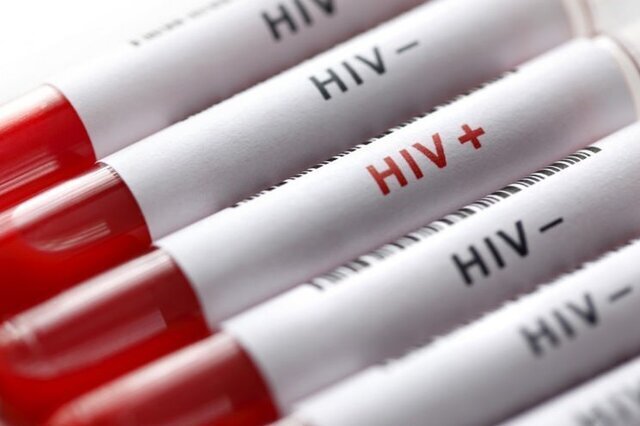 HPV از طریق استخرها و توالت ها منتقل می شود؟