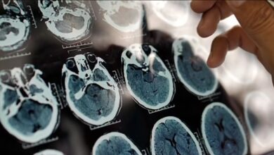 هشدار در مورد شروع آلزایمر از 5 سالگی/ عوامل مؤثر در جلوگیری از آلزایمر