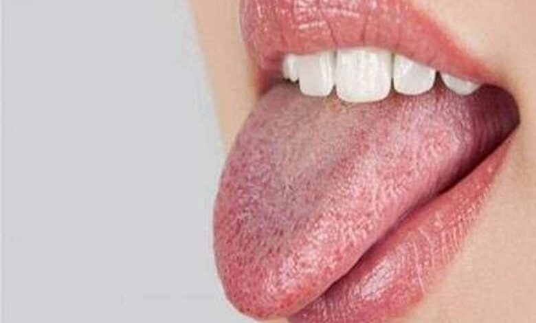 زبان سفید در مورد سلامتی چه می گوید؟
