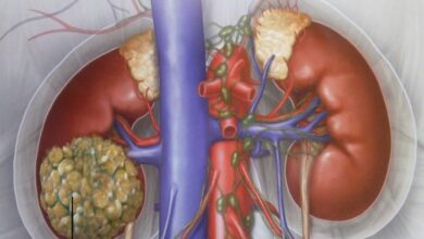 درمان ترکیبی دارو برای مشکلات کلیه در بیماران دیابتی نوع 2 - آژانس خبری مهر | اخبار ایرانی و جهانی
