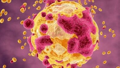 تومورهای پوستی ؛ چهره پنهان بیماری