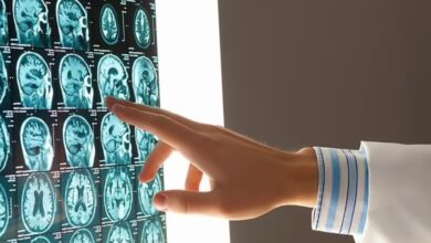 هوش مصنوعی دو نوع زوال عقل را با دقت 2 ٪ مشخص کرد