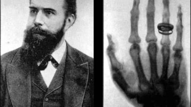 هنگامی که علم بدن را شفاف کرد. از تابش مرموز گرفته تا نگاهی به بدن/ تکامل تصویربرداری پزشکی