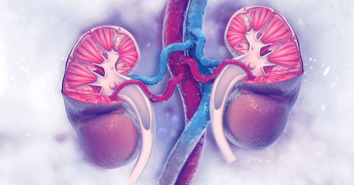 هیدرونفروز ؛ از عوامل و علائم بیماری گرفته تا راهکارهای مؤثر پیشگیری