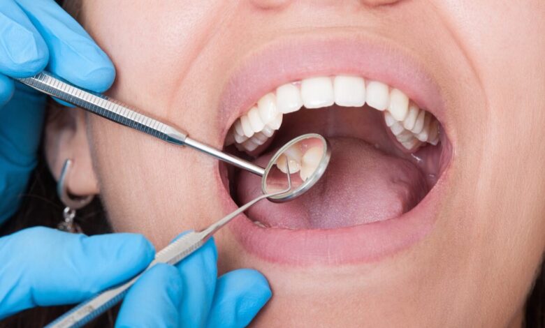 تأثیر استرس بر سلامت دهان و دندان