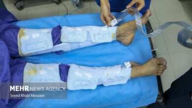 بیماران پیوند غیر کمبود - آژانس خبری مهر | اخبار ایرانی و جهانی