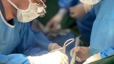 انجام پیوند 2،000 کبد در بیمارستان امام در تهران - آژانس خبری مهر | اخبار ایرانی و جهانی