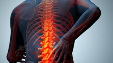 برگشت ناپذیری صدمات نخاعی در غیرانتفاعی