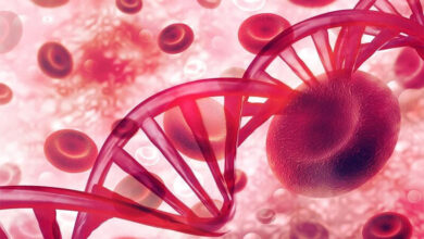 خستگی ، تنگی نفس ، سرگیجه و تپش قلب از جمله علائم کم خونی